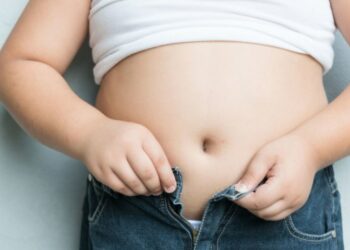 ΠΑΙΔΙ ΥΠΕΡΒΑΡΟ παχυσαρκια