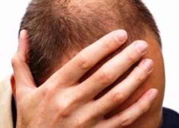 ΦΑΛΑΚΡΑ ΠΟΝΟΚΕΦΑΛΟΣ