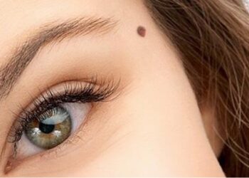 Ελιά ομορφιά