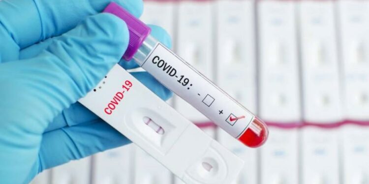 Δωρεάν rapid test