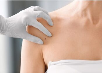 Τι κοινά υπάρχουν ανάμεσα στις παθήσεις νυχιών και στην χαρτογράφηση σπίλων