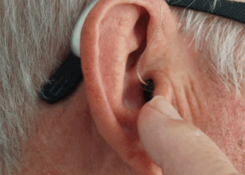 Επίδομα βαρηκοΐας: Πότε ανοίγουν οι αιτήσεις για ηλικίες 18 έως 65 ετών