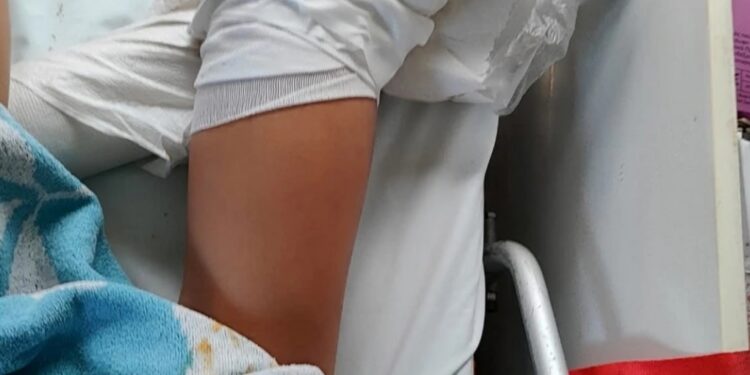 26χρονη τραυματίστηκε από ομπρέλα στην παραλία: «Θύμα» των ισχυρών ανέμων