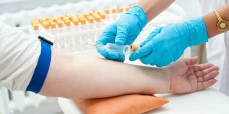 Τροφές που ανεβάζουν τον αιματοκρίτη: Ποιες είναι – Πόσο πρέπει να τρώτε